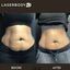Laser hair removal (2) - Laserbody MD
