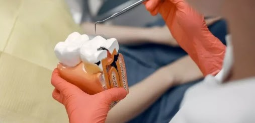top dentist NJ Affordable Same Day Root Canal