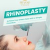 Rhinoplasty in Visakhapatnam - Rhinoplasty in Visakhapatnam