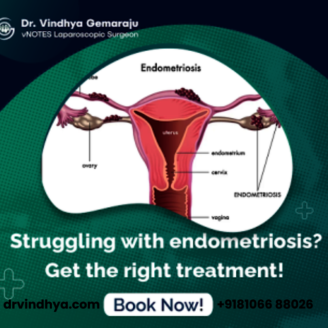Best Doctor for Adenomyosis in Hyderabad (1) Picture Box