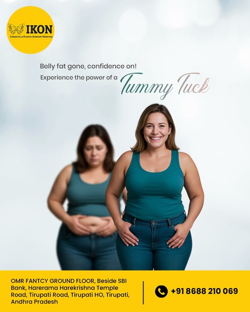 Tummy Tuck Treatment in Tirupathi Picture Box