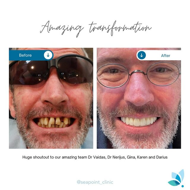 Best dentist in Sandyford (2) Seapoint Dental Clinic @The Beacon Sandyford