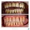 Dentists Near me (2) - Seapoint Dental Clinic @The...