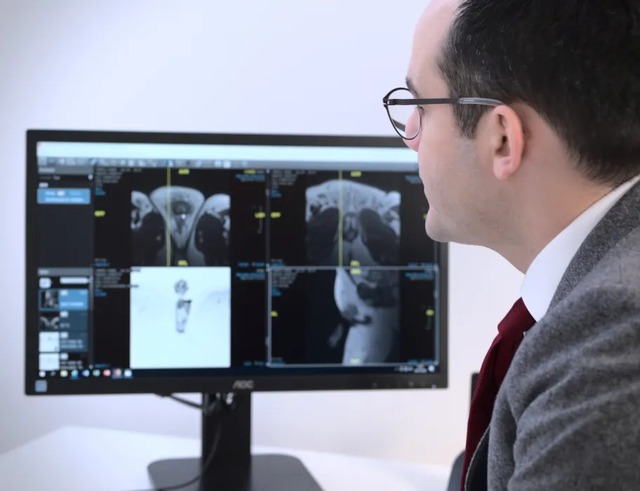 imgi 8 tvac2o5b1sylgbzogsey docteur François-Xavier Madec, urologue expert en sténoses de l’urètre, chirurgie pénienne et andrologie reconstructive