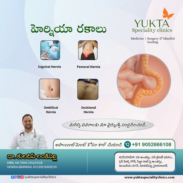 hernia types and symptoms Picture Box