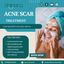 Acne Scar Treatment - Shino... - Shinora Clinic