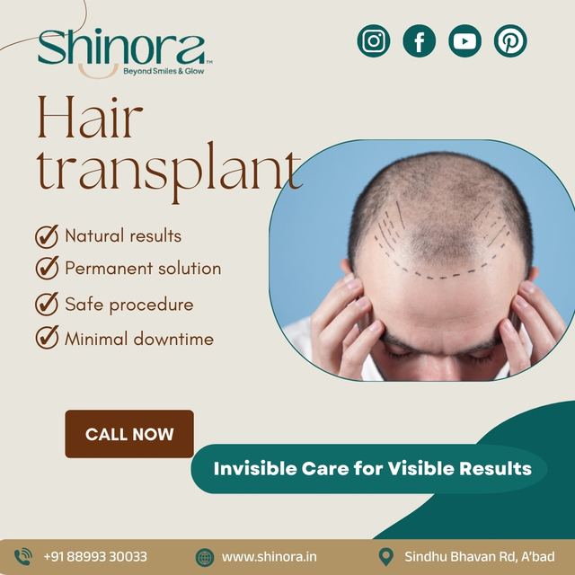 Hair Transplant - shinora clinic  Shinora Clinic