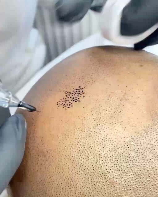 Haarfarbe und Pigmentierung München Picture Box