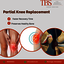 Partial Knee Replacement Su... - Orthopedic Surgeon