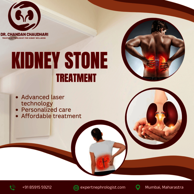 Kidney stone  treatment in Mumbai Kidney Transplant Surgeon