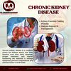 Chronic Kidney Disease Trea... - Kidney Transplant Surgeon