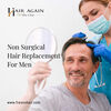 Non-surgical-hair-replaceme... - Picture Box
