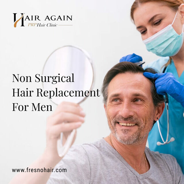 Non-surgical-hair-replacement-for-men Picture Box