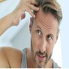 Hair Transplants For Men