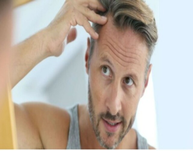 hair transplant for men (1) Hair Transplants For Men