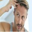 hair transplant for men (1) - Hair Transplants For Men