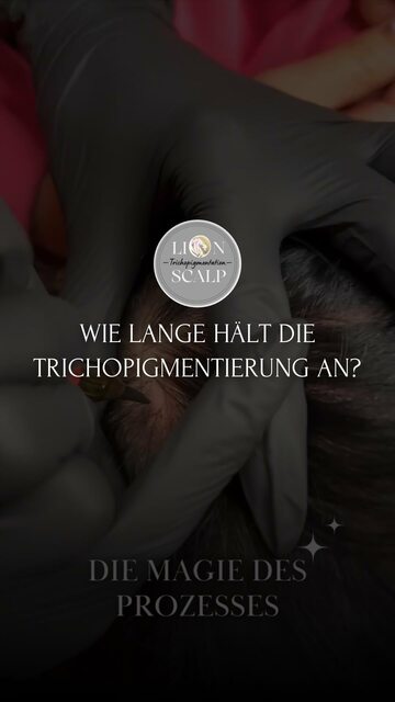 Trichopigmentation München | lionscalp-smp Picture Box