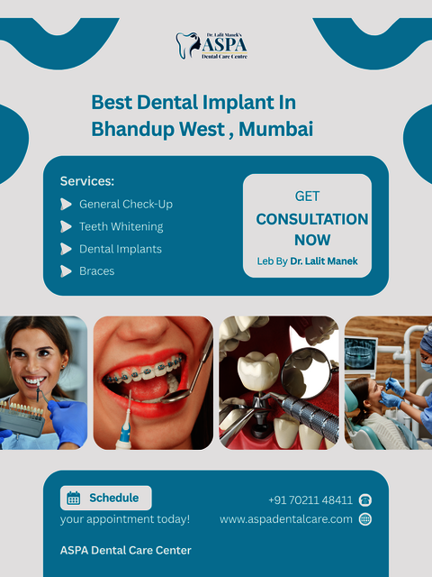 Best Dental Implant in bhandup west ASPA Dental Care