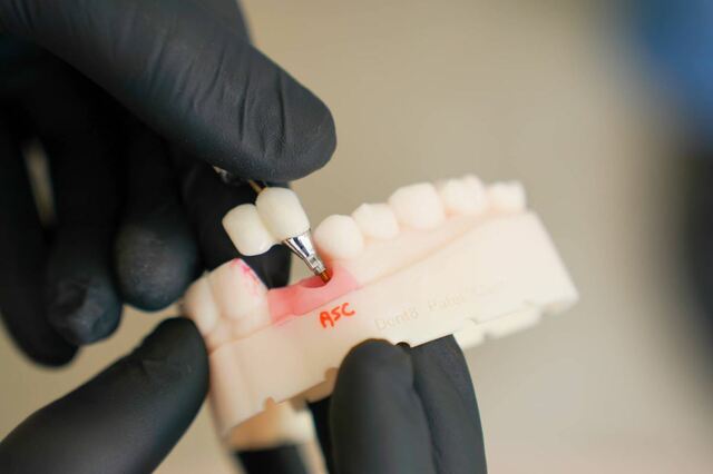 Emergency dentist Preston XO Dental