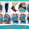 fracture-support-1 - Picture Box