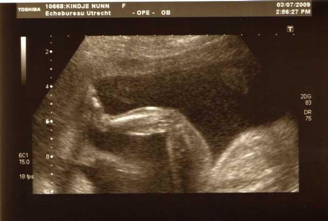 img018 Zwangerschap 2009