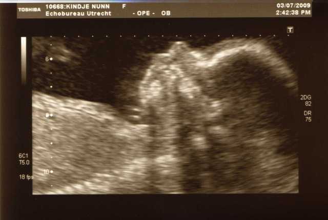 img014 Zwangerschap 2009