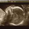 img016 - Zwangerschap 2009