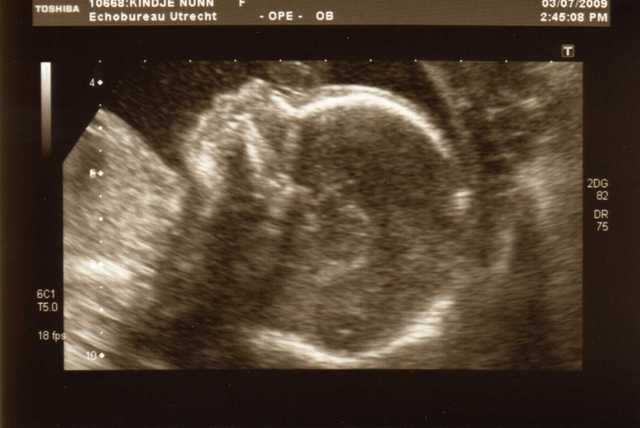 img017 Zwangerschap 2009
